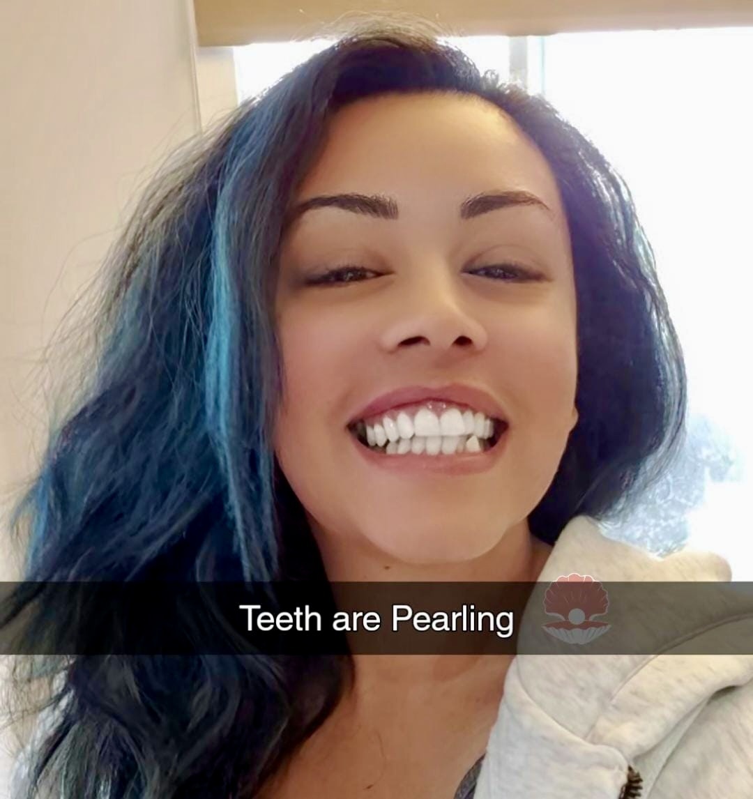 Whiter Teeth